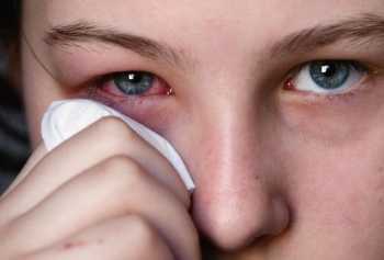 воспаление глаза как вылечить в домашних условиях